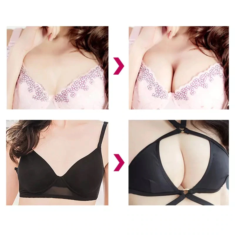 PlumpUp - Aumento de Seios